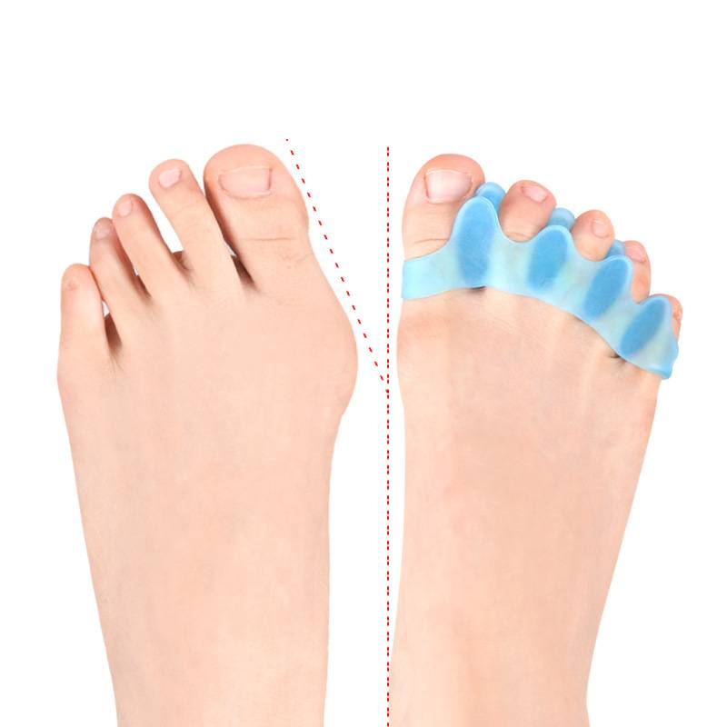 1/5Pairs Silicone Toe Separato - Yoga Toe Separator avaliação e preço