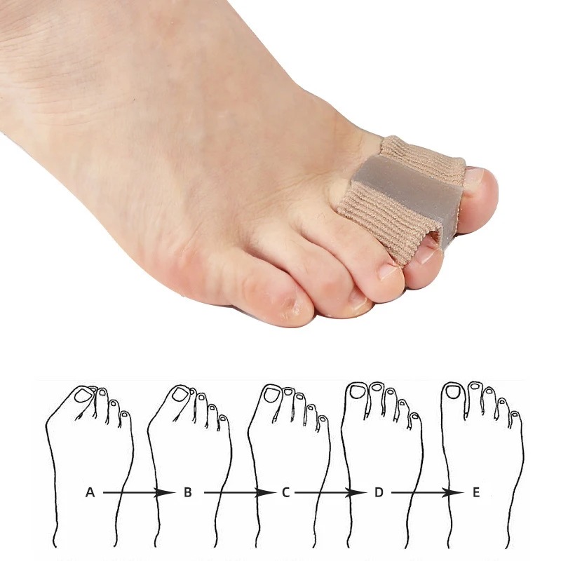 4PC Silicone Toe Separator Fin - Yoga Toe Separator avaliação e preço